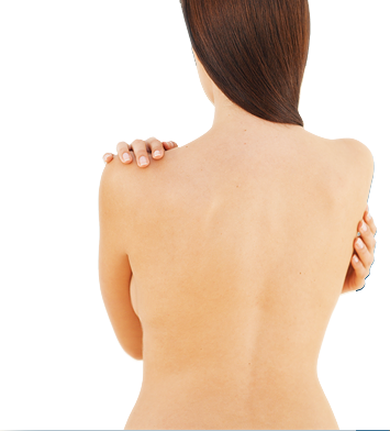image of model - see before and after section for pictures of actual patients